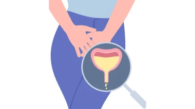 Managing Urinary Incontinence in Women: Causes & Solutions