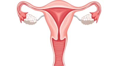 Vaginismus