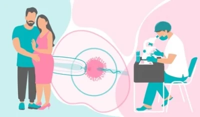 ICSI (Intracytoplasmic Sperm Injection)
