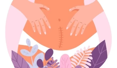 Labiaplasty: Causes, Benefits & Treatment Options