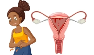 Vaginal Dryness: Causes, Symptoms & Treatment Options
