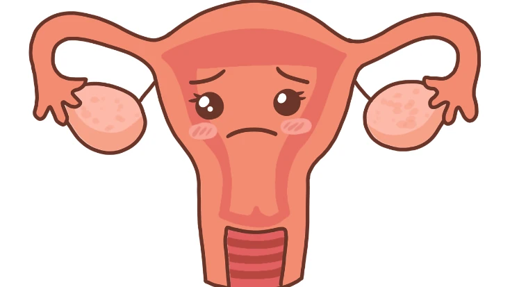 Blocked Fallopian Tubes: Causes, Symptoms, and Treatment