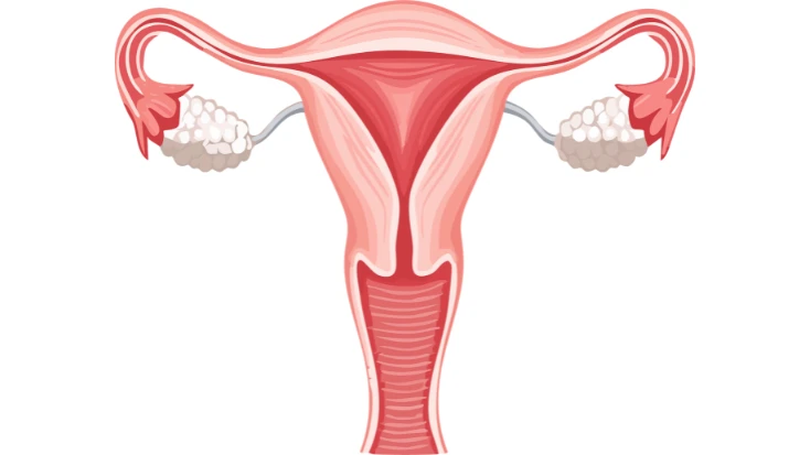 Vaginismus