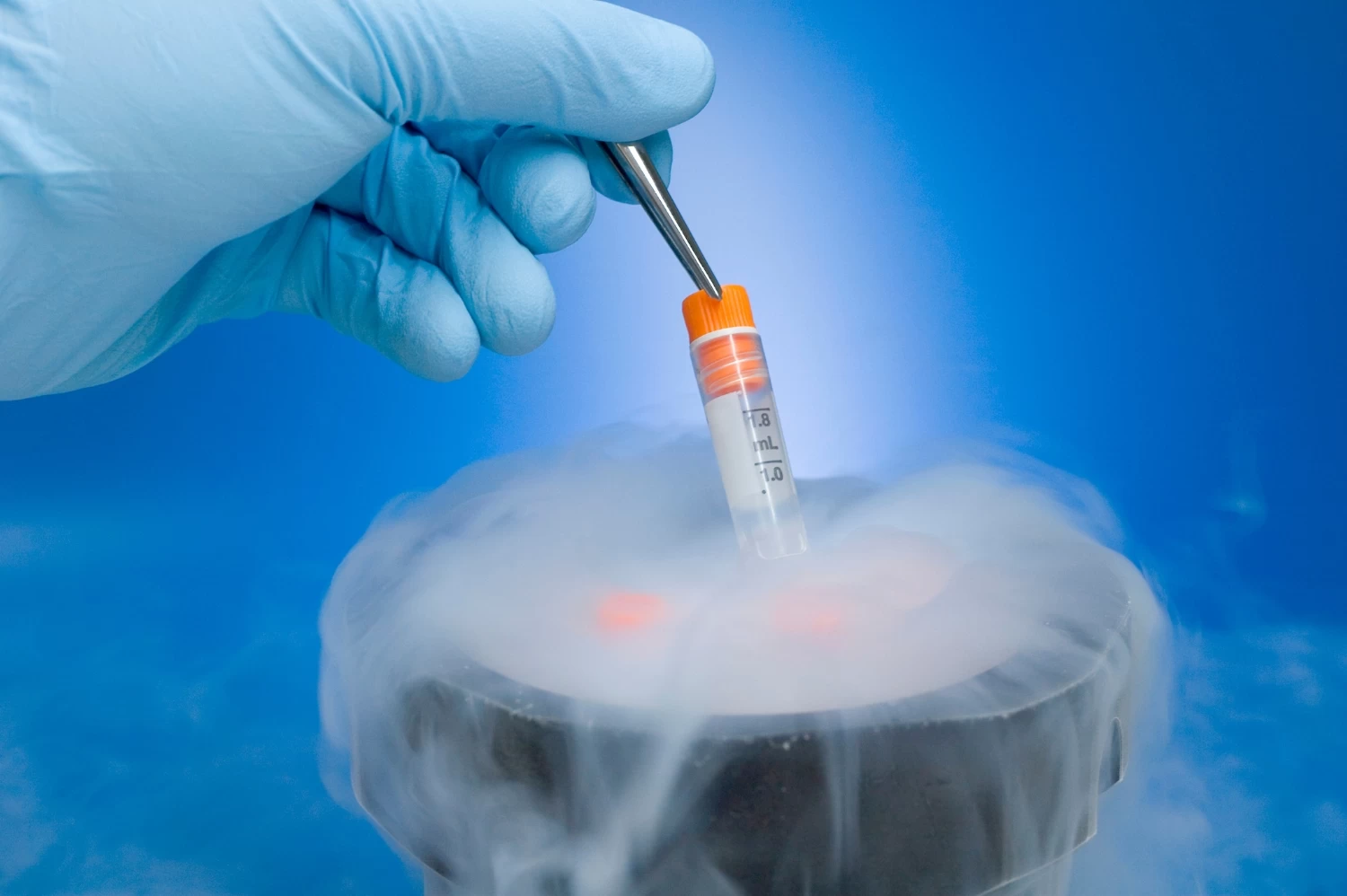 Egg Freezing (Oocyte Cryopreservation): Benefits, Ideal Age & What You Should Know