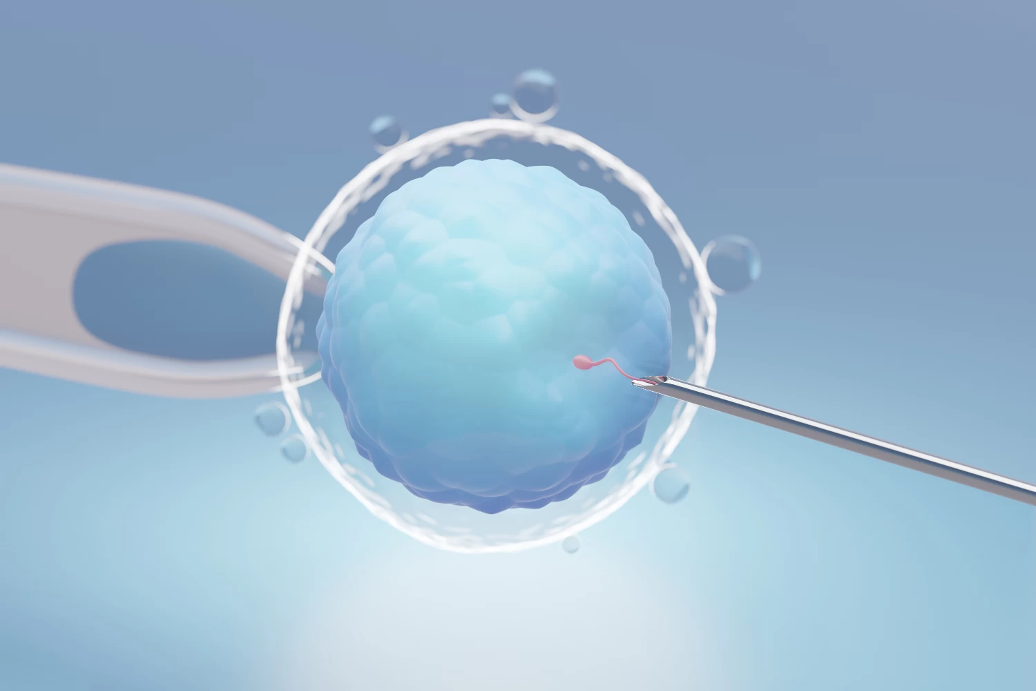 IUI (Intrauterine Insemination)